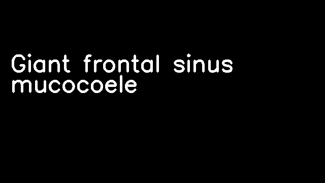 Giant frontal sinus mucocoele