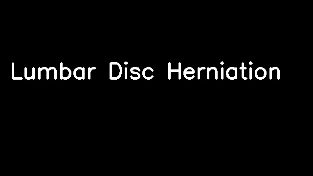 Lumbar Disc Herniation