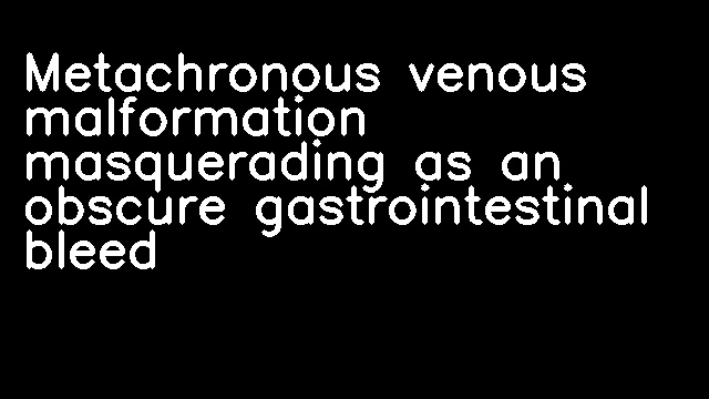 Metachronous venous malformation masquerading as an obscure gastrointestinal bleed