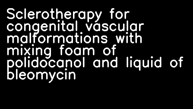 Sclerotherapy for congenital vascular malformations with mixing foam of polidocanol and liquid of bleomycin