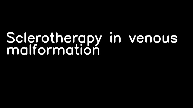 Sclerotherapy in venous malformation