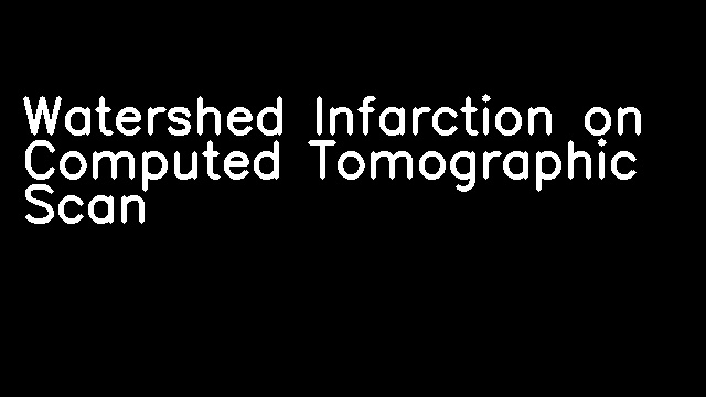 Watershed Infarction on Computed Tomographic Scan